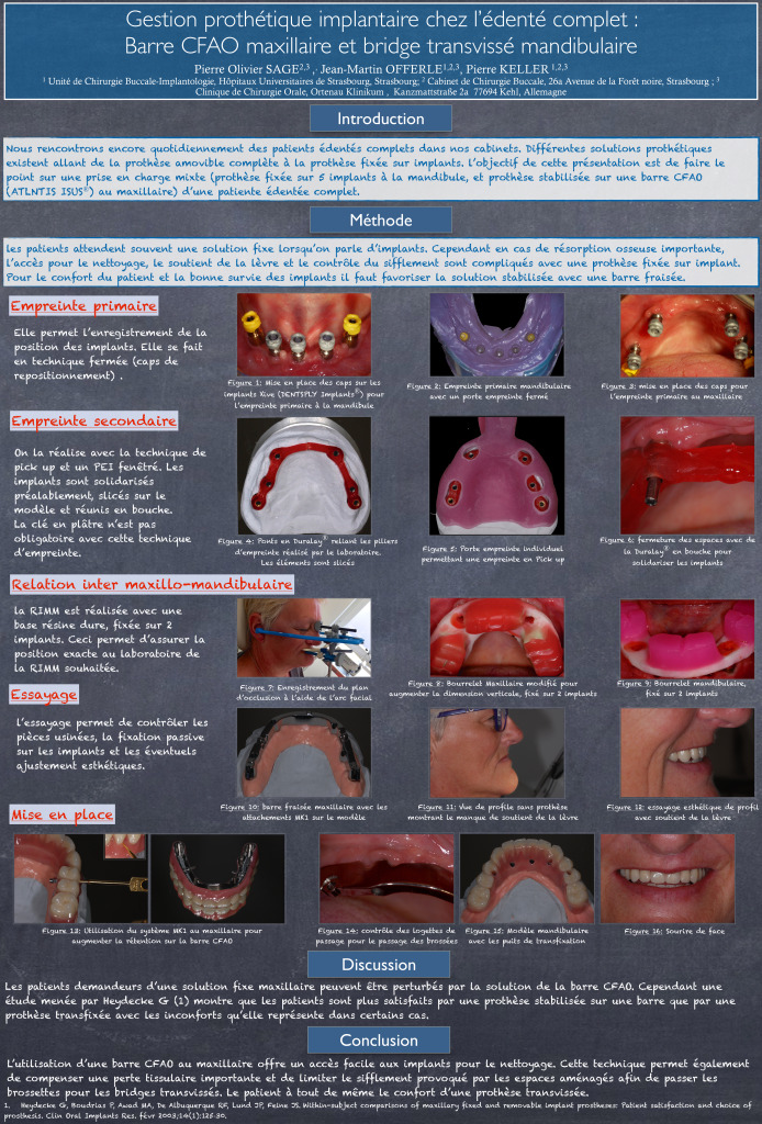 thumbnail of Gestion protétique implantaire
